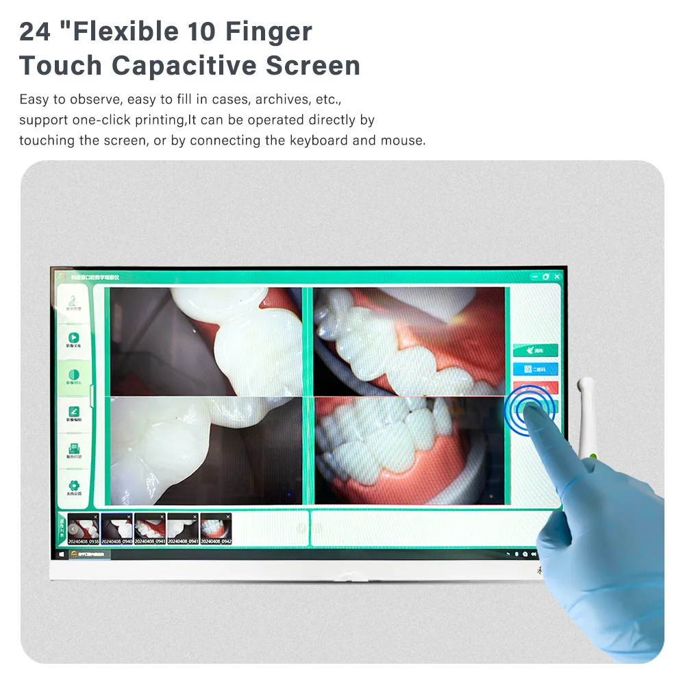 24-дюймовый сенсорный экран Windows 10 Den tal Intraoral Cam Era с Mon itor