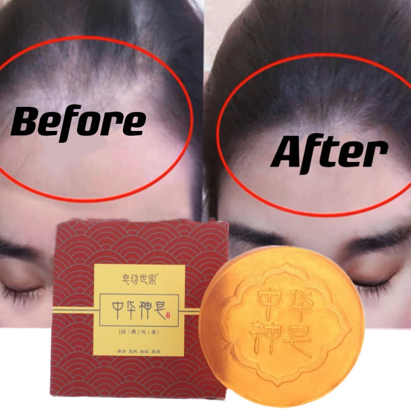 

Шампунь-мыло 3 в 1 для устранения клещей и восстановления волос