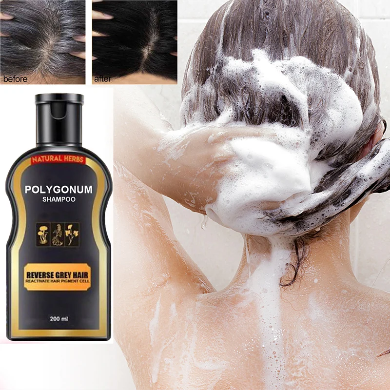 200ml Hair Loss Treatment Shampoo Hair care Shampoo Bar Ginger Hair Growth Cinnamon Anti-hair Loss Shampoo Polygonum multiflorum