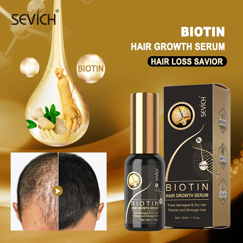 

Sevich Biotin Hair Growth Essence Oils Hair Loss Treatment 30ml Natural Ginger Prevent Hair Thinning Hair Regrowth Serum