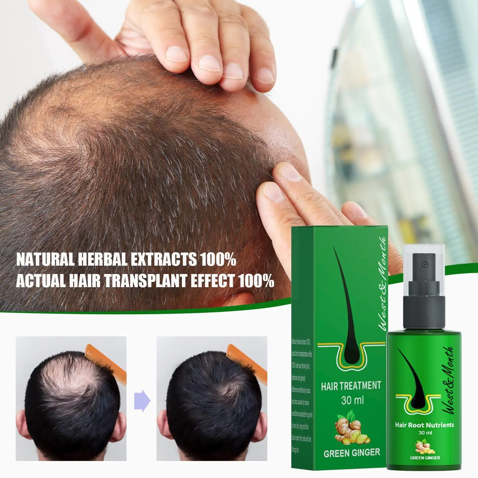 

Hair Regrowth Serum Spray Fast Hair Growth Lotion Spray Strengthening Essence Hair Scalp Growth Natural Hair Nourishin Care Q1C0