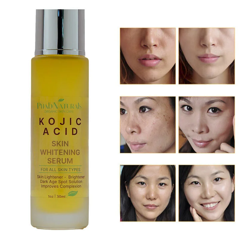 

KOJIC ACID Skin Whitening Lightening Brightening Serum Bleaching Spot Fade Cream Lighten Acne Spots, Age Spots Even Skin Tone