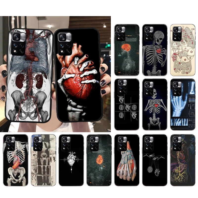

Human Organs Skeleton Skull Brain Phone Case for Xiaomi Redmi Note 12 Pro 11S 11 10 Pro 9Pro Note9 10S Redmi 10 9C 9A Funda