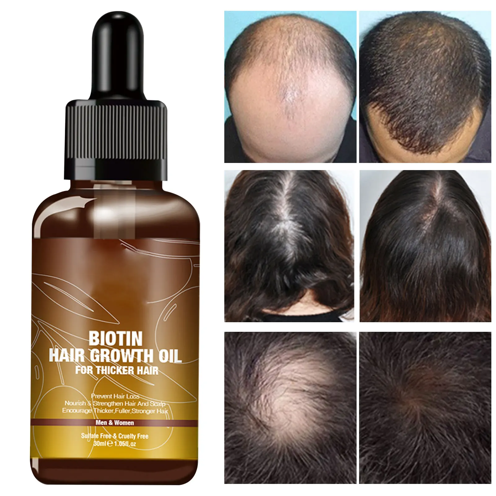 

Hair Growth Oil Liquid Hair Growth Serum Anti Hair Loss Baldness Remedy Boost Grow Thicker Hair Care Scalp Treatments