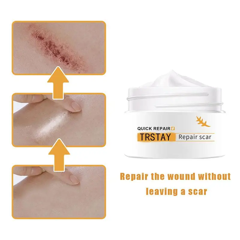 

Scar Repair Cream Skin Wound Cream Burning Fading Cream Surgery Repair Scar