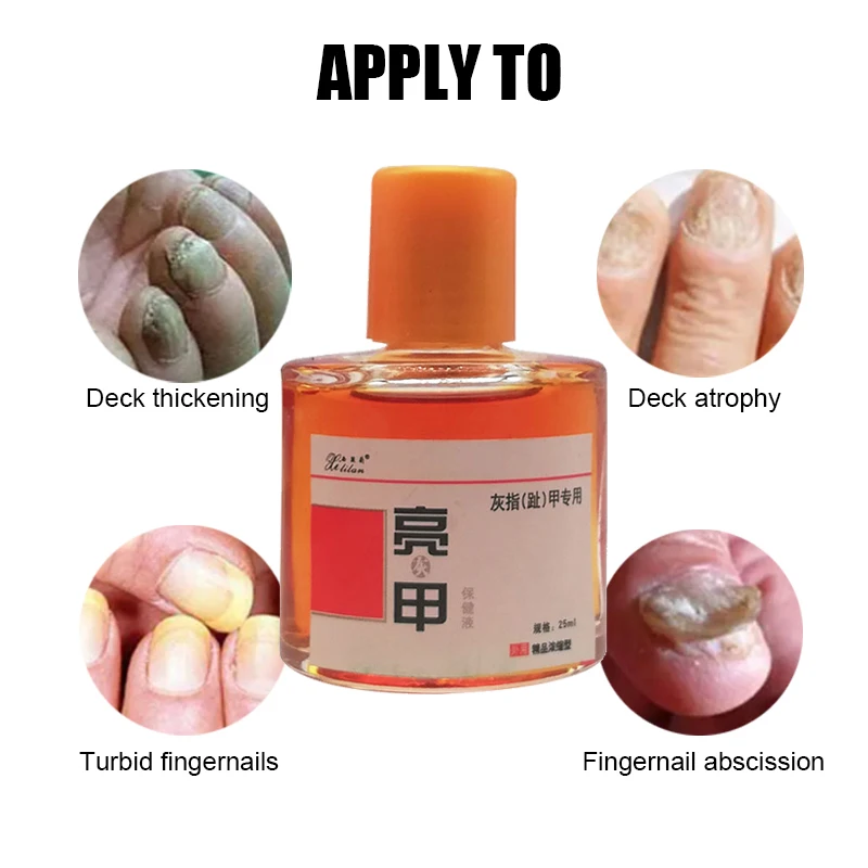 

25ML Nail Fungal Care Liquid Foot Toe Anti Infection Oil Paronychia Onychomycosis Dressing Treat Feet Fungus Removal Essence