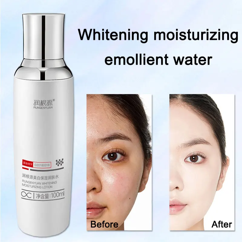 Rungenyuan Toner for face 100ml Whitening skin moisturizing face spray tonic facial care Blocca Moisturizing facial hydrating