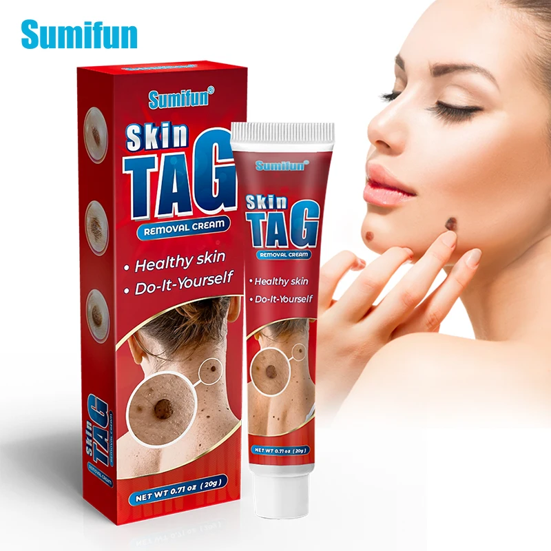 

20g Sumifun Wart Treatment Cream Warts Removal Antibacterial Ointment Remove Skin Tag Foot Corn Mole Acne Herbal Medical Plaster