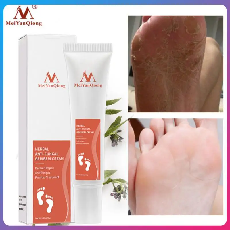 

Увлажняющий крем для кожи ног, крем для пятки, отбеливающий крем, пилинг для ног, удаление трещин и восстановление рук, против трещин