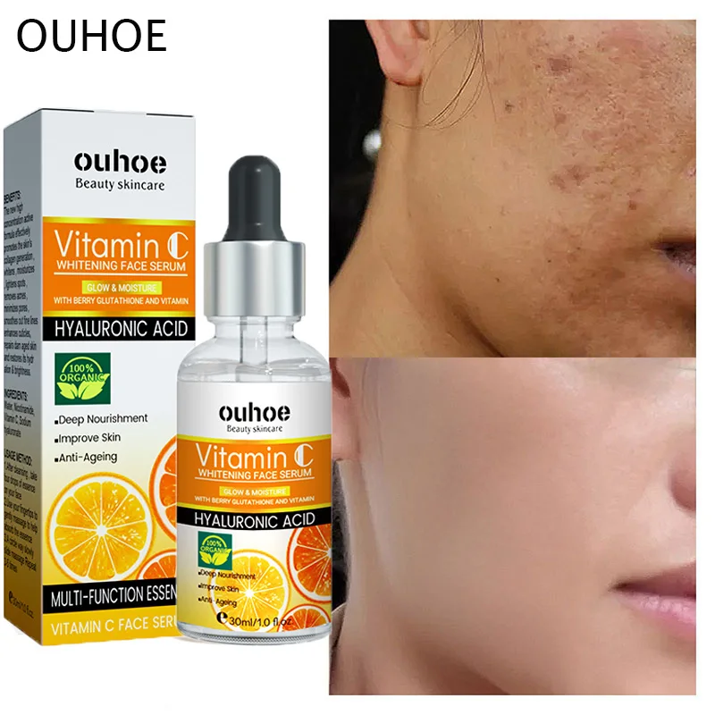 Vitamin C Whitening Face Serum Freckles Removal Brighten Nicotinamide Anti Wrinkle Fade Dark Spot Essence Moisturizing Skin Care