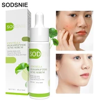 face serum moisturizing acne treatment eliminate blackheads oil control centella soothes repairs damaged nourish skin care 30ml