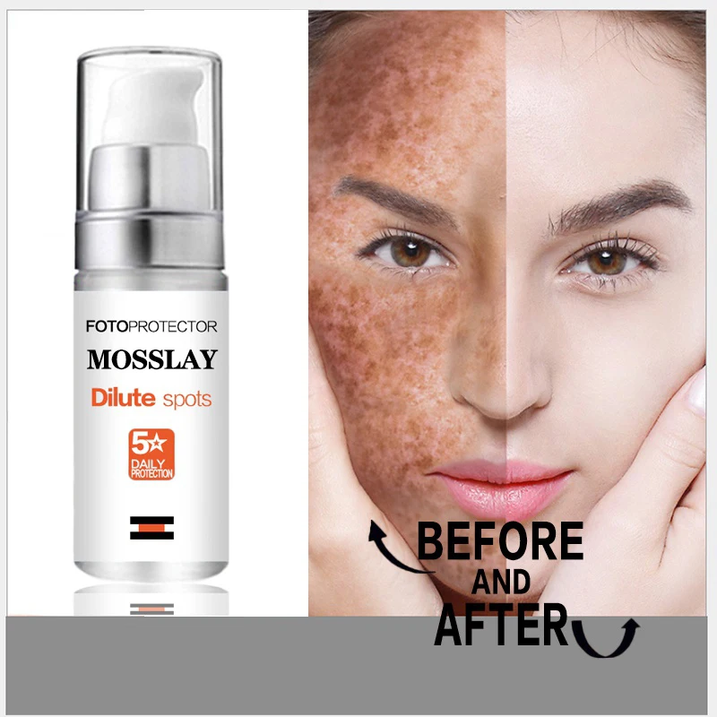 

Mosslay Whitening Freckle Cream Remove Melasma Cream Remove Dark Spots Melanin Melasma Remover Brighten Skin Anti-Aging