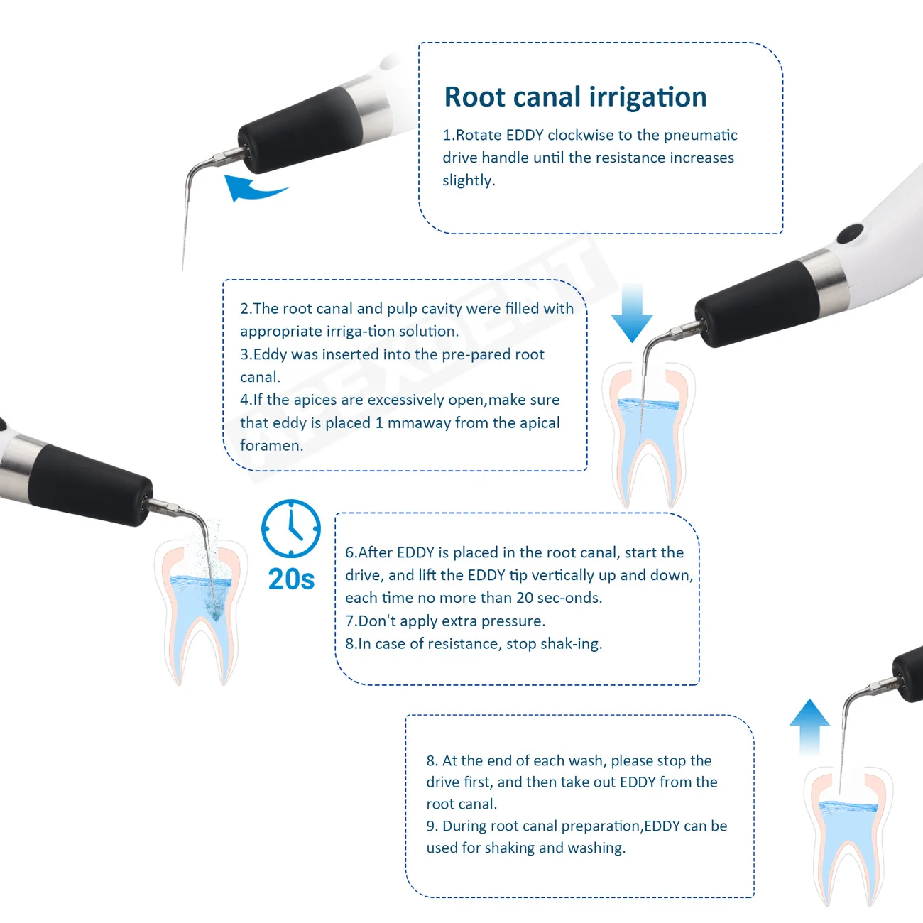 Беспроводной эндодонтический ирригатор Dental Endo Ultra Activator с 6 бесплатными насадками, стоматологический инструмент для корневых каналов (art.: 3920da17453dc) - 3920da17453dc