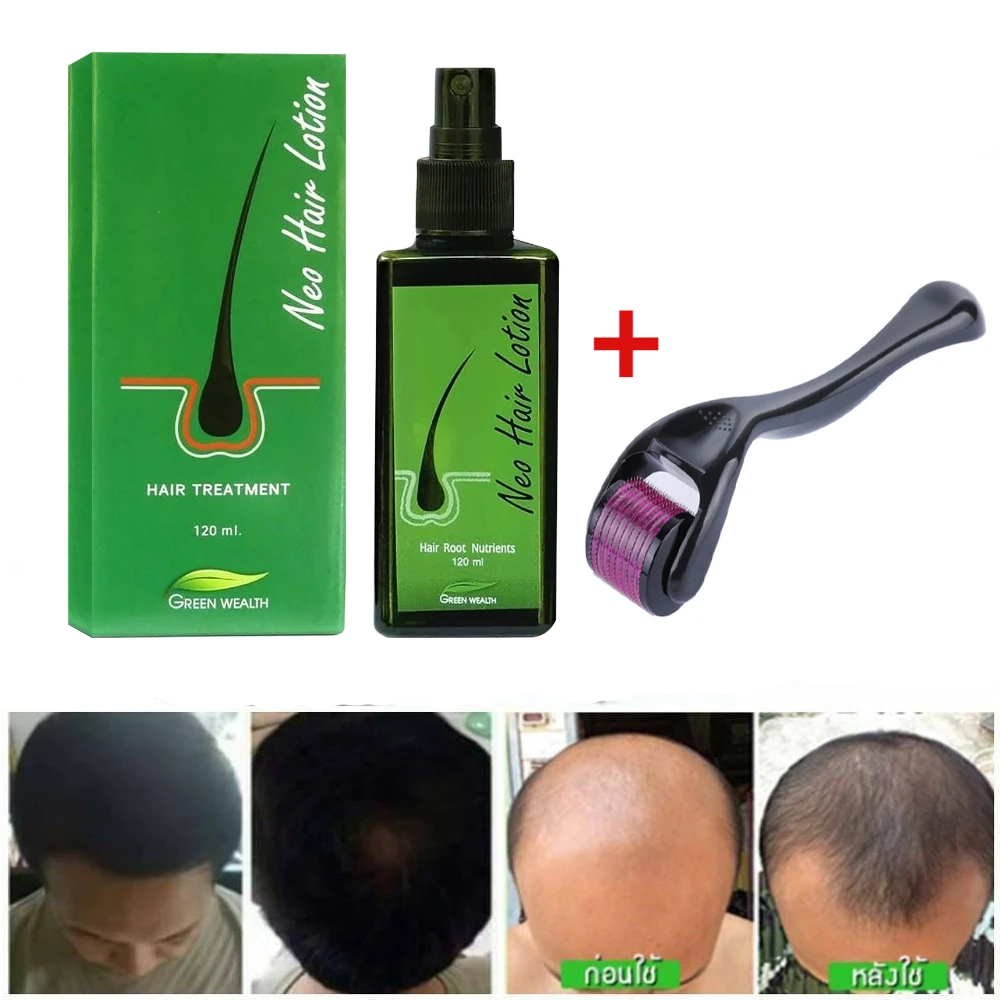 1pc  Neo Hair Lotion 120ml Made In  Essence Prevents Hair Loss Scalp Treatment For Man Woman Hair Growth