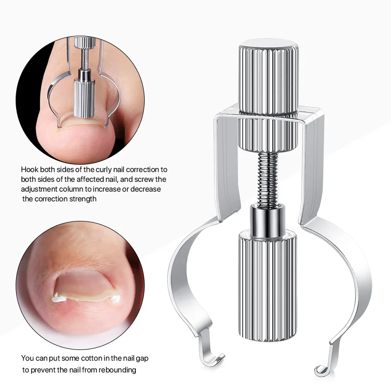 

Ingrown Toenail Corrector Lifter Ingrown Toenail Tool Toe Clamp Stainless Steel Foot Care Tool for Paronychia