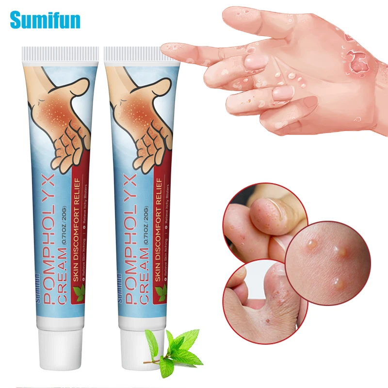 

Мазь Sumifun для удаления пота и герпеса, антибактериальный медицинский крем для удаления зуда у рук и ног, восстанавливающий крем, Desquamate, 20 г