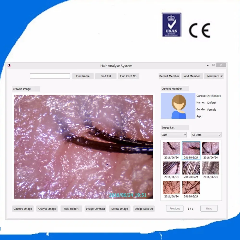 Анализатор диагностики иррископа кожи волос с анализами + ириса все в 1 машине