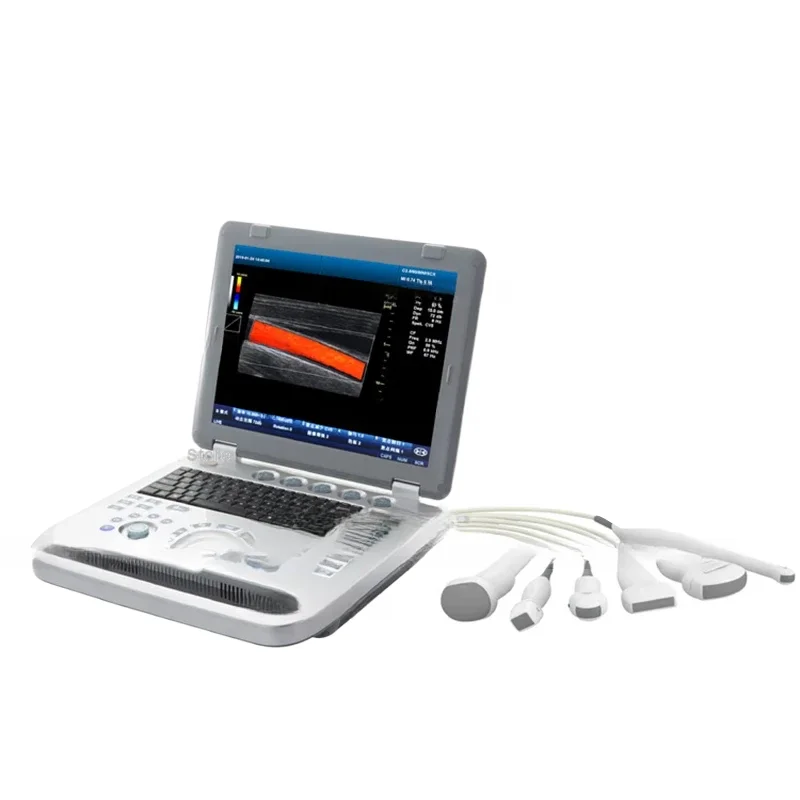 Vscan Air Diagnostic Беспроводной двойной зонд для сжигания жира Нервный плекс