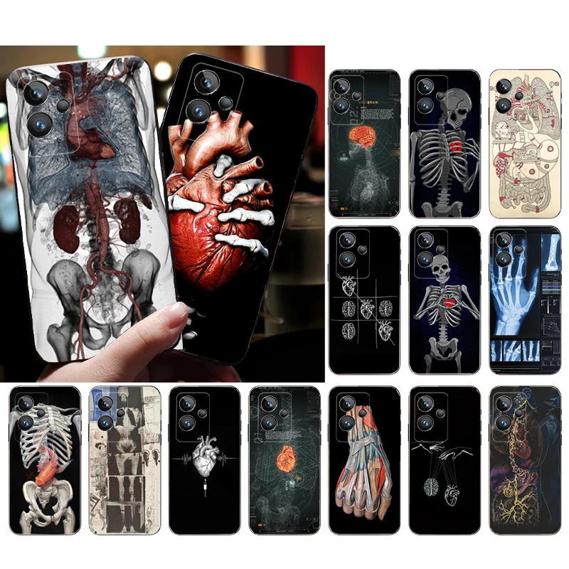 

Organs Skeleton Skull Brain Case for OPPO Realme 10 Pro Plus 9 8 7 6 Pro 6i GT 2 Pro X2 Pro C21Y C11 X3 SuperZoom GT Master
