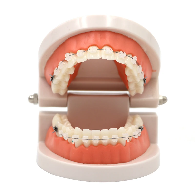 

1pc Dental Orthodontic Model All Ceramic Bracket With Anti-nail For Dentist Medical Disease Teaching Study