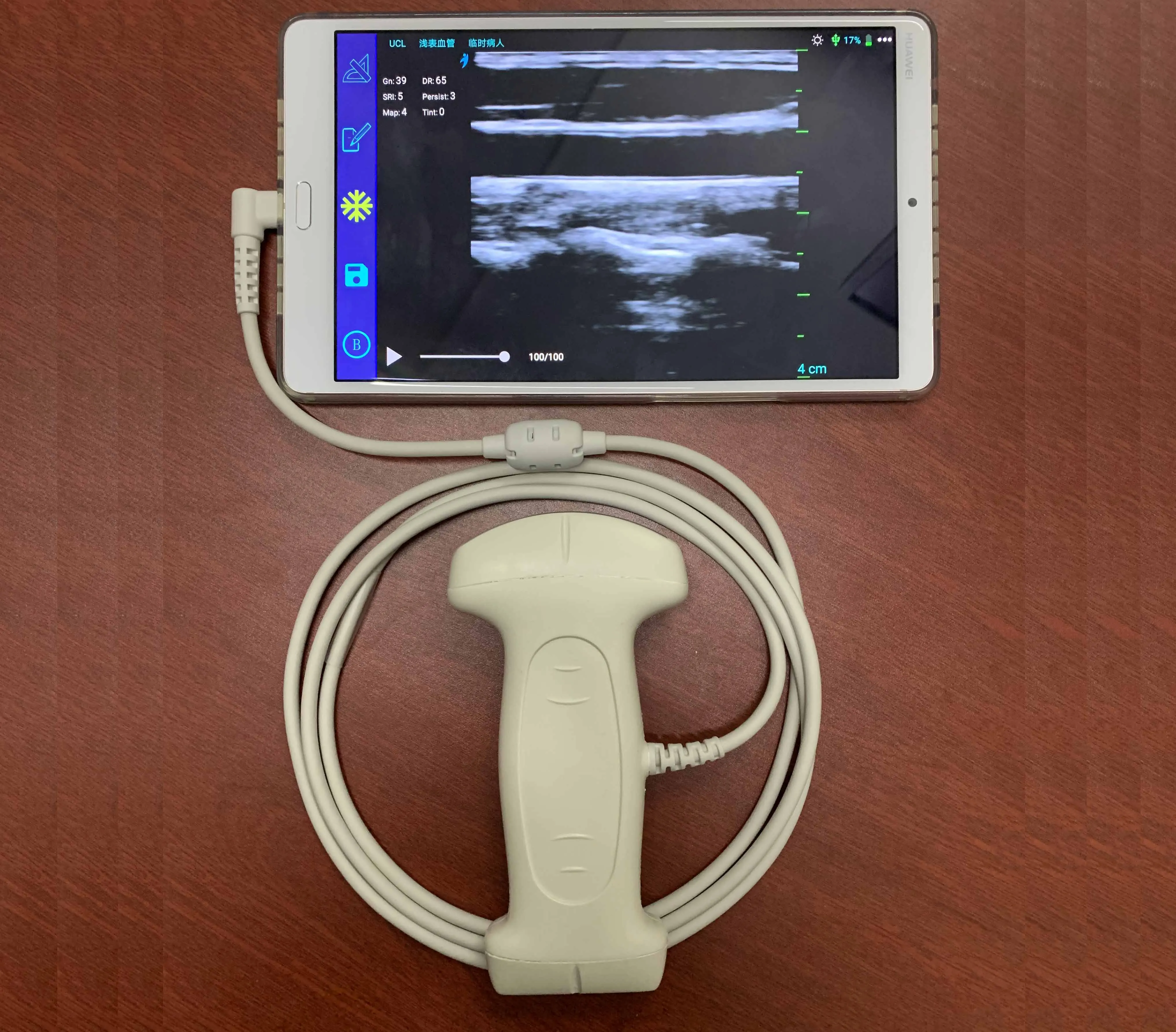 Convex-Linear in One Ultrasound Probe  with USB/Type C Connector for Android Mobile Phone and Microsoft Computer