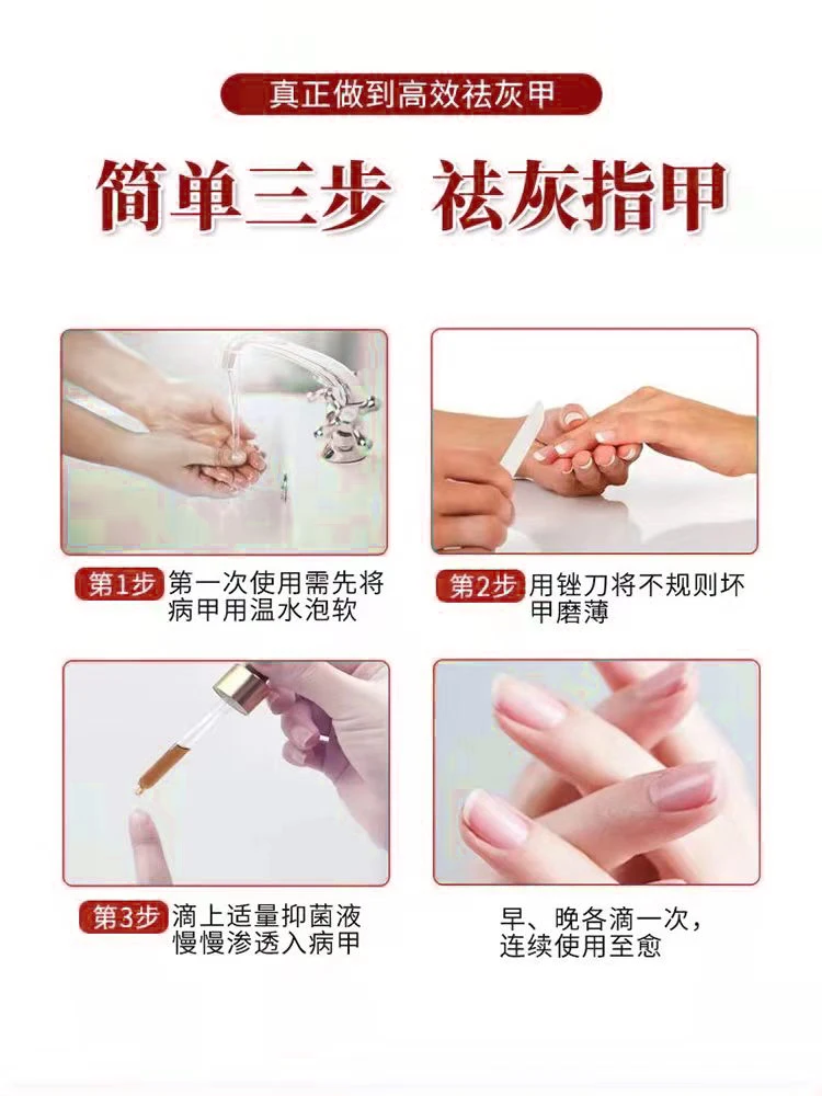 [Watsons Hot Sale] It Is Invalid to Remove 99% Gray Potassium Fungus by Dropping a Drop of Antibacterial and Not Removing Nail!!
