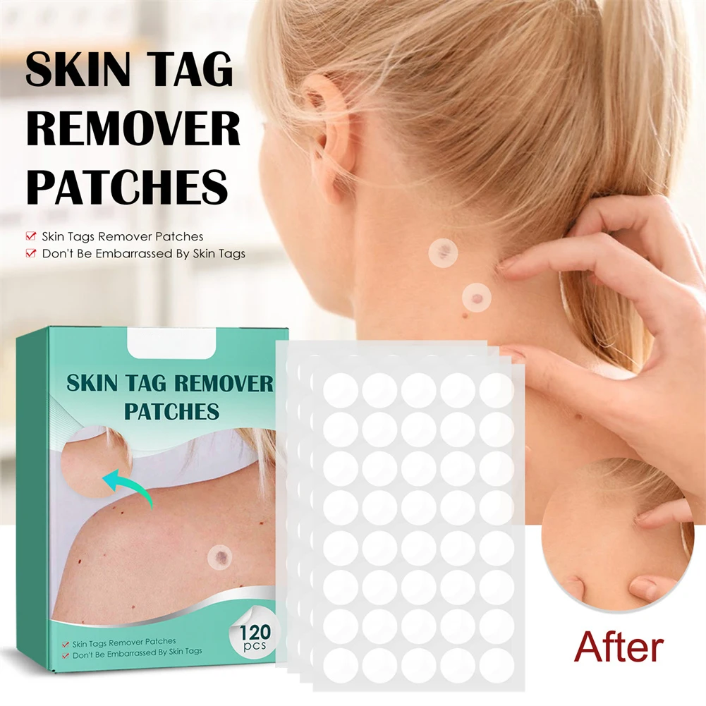 

120pcs/Box Skin Tag Remover Patch Wart Stickers Hydrocolloid Gel Acne Warts Skin Care Warts Remover Plaster Foot Corn Plaster