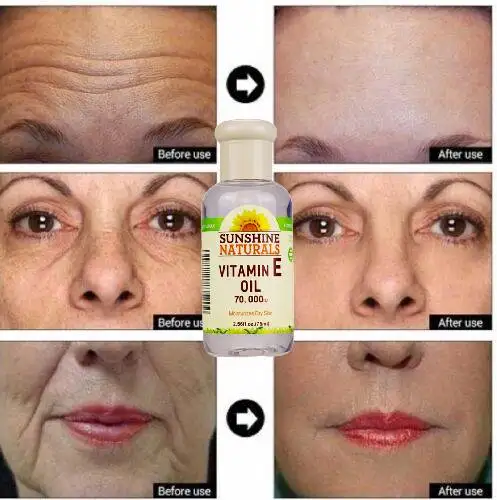 

Remove Dark Spots Turmeric Essential Oil Anti Wrinkle Face Serum Acne Shrink Pores Whitening Moisturizing Skin Care Face Serum