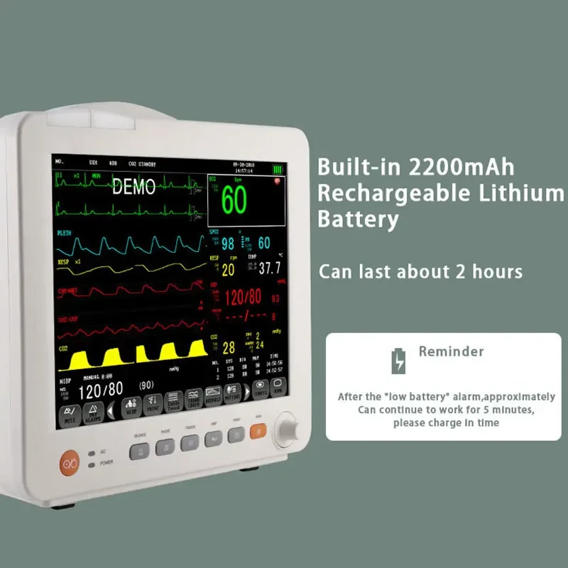 ЭКГ-монитор медицинский бытовой многопараметрический портативный 24-часовой
