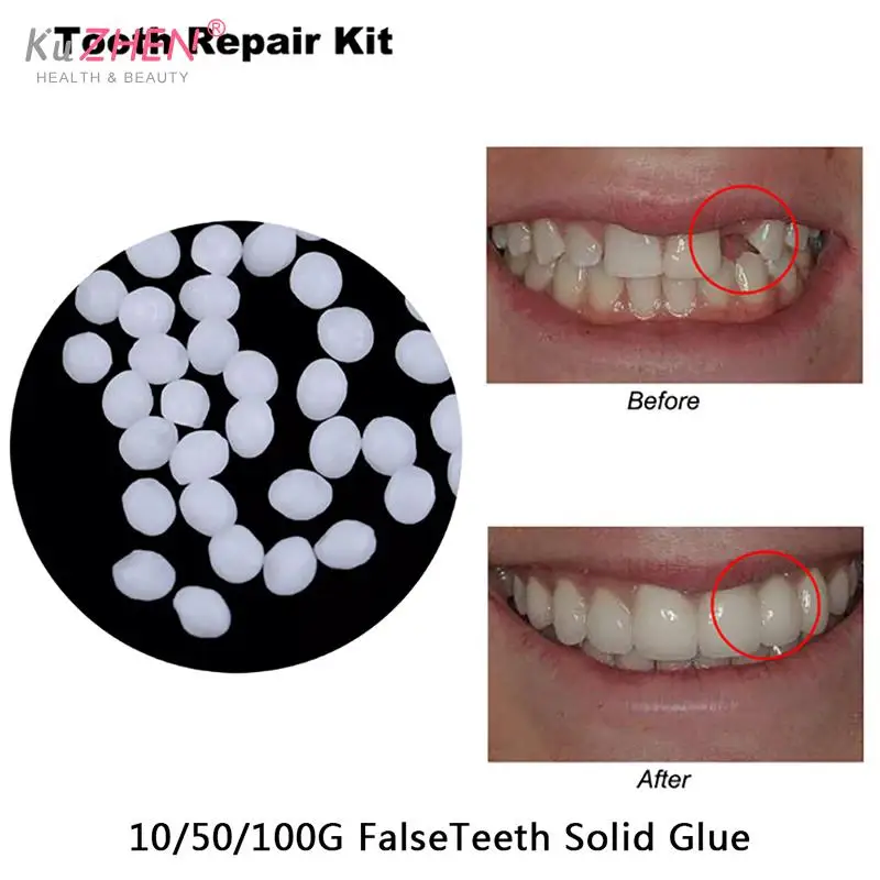 

Resin FalseTeeth Solid Glue Temporary Tooth Repair Set Teeth And Gap Falseteeth Denture Adhesive Teeth Dentist 10g/50g/100g/Bag