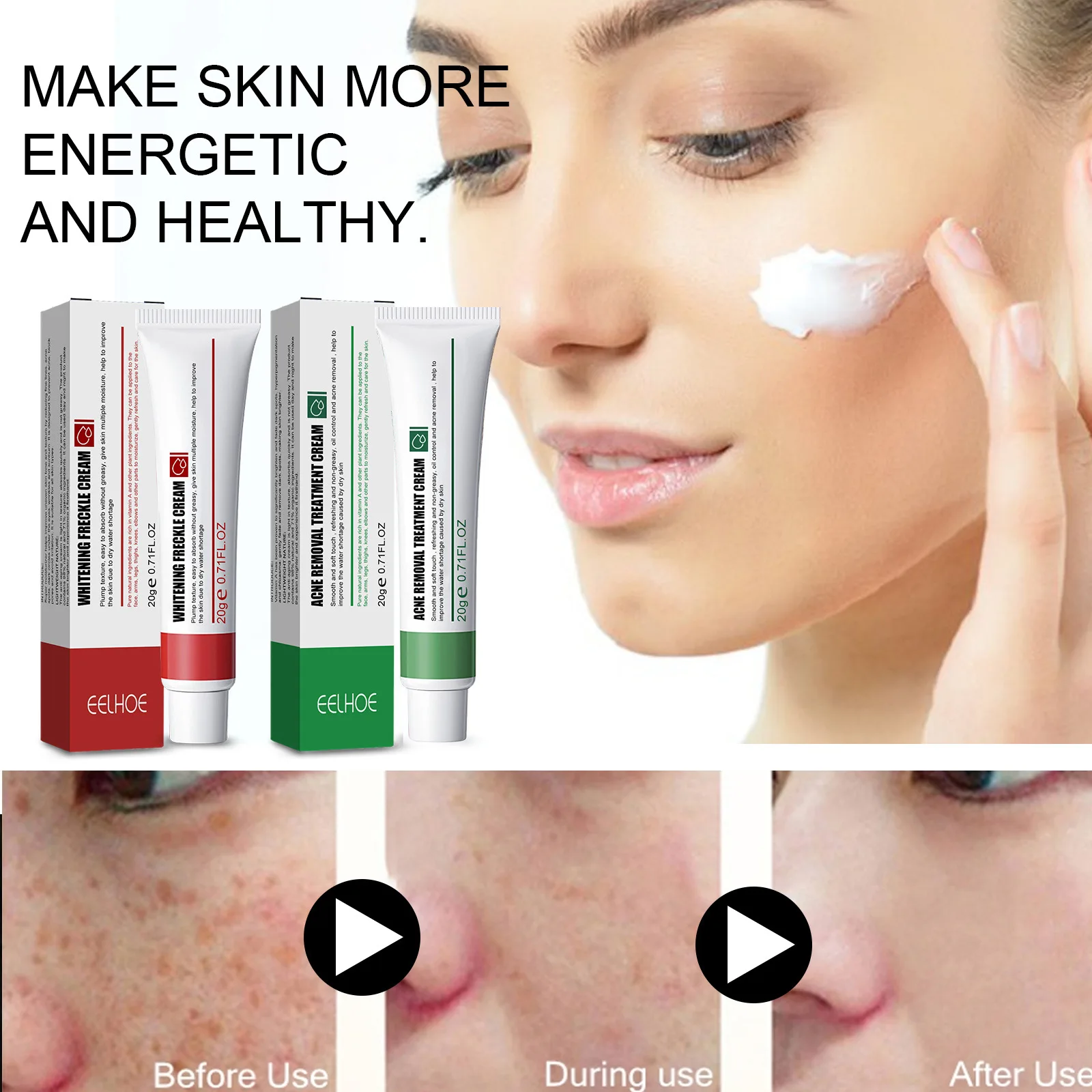 

Acne removing cream lightens spots, brightens skin tone, moisturizes skin, acne spots skin care and repair cream