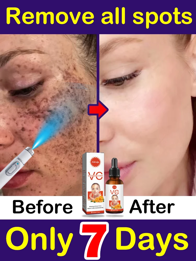 Clear Sun Dark Age Spot Веснушки