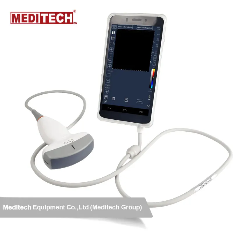 

Smart ultrasound, Android portable ultrasound