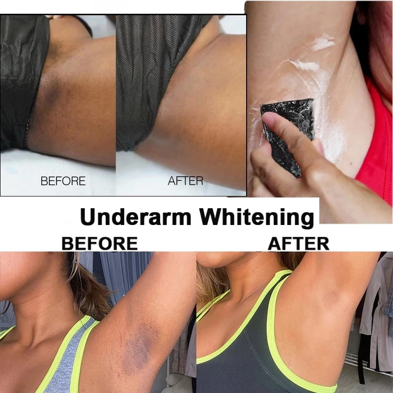 

100g Skin Whitening Soap Bamboo Charcoal Handmade Soap Lighten Dark Bikini Line Ladies Vaginal Whitening Soap Skin Cleansing