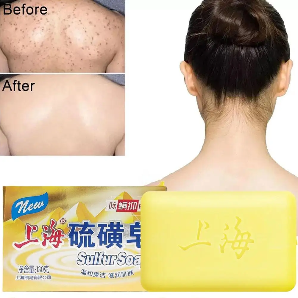 

130g Shanghai Sulfur Soap Acne Psoriasis 4 Skin Conditions Eczema Fungus Anti Perfume Seborrhea Bath Butter Bubble G9B2