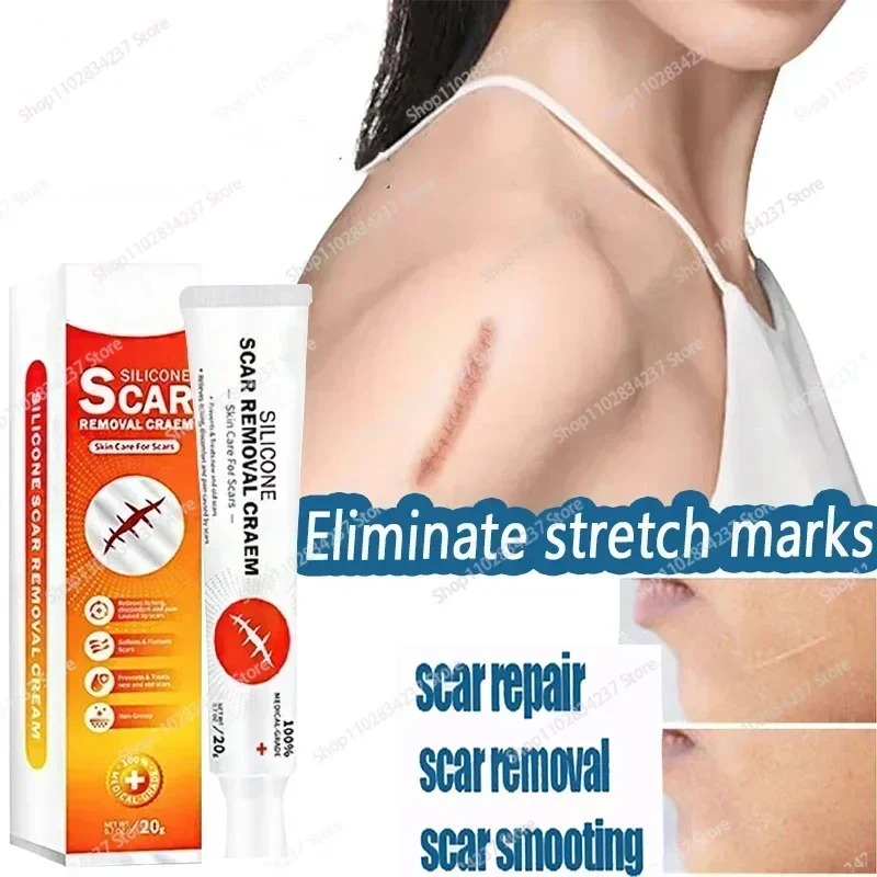 Крем для удаления растяжек на беременности устраняет красные - Цена: 4789