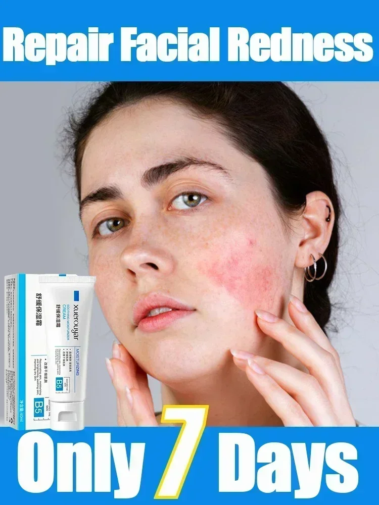 Мгновенный крем для восстановления красных точек на лице Успокаивающий Крем
