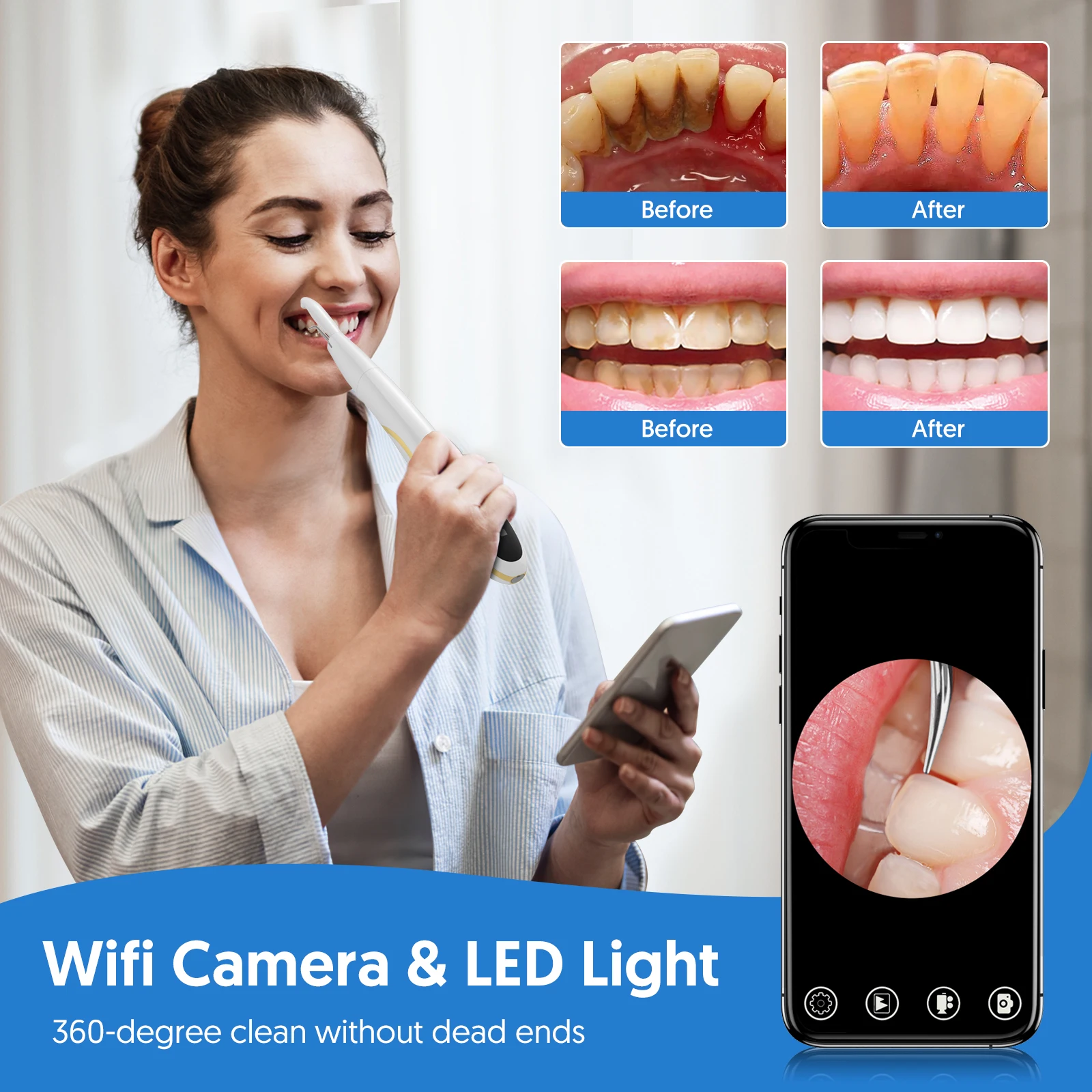 

Ultrasonic Dental Scaler Tartar Remover Mouth Washing Machine Teeth Whitening With Hd Camera Teeth Calculus Dental Cleaning