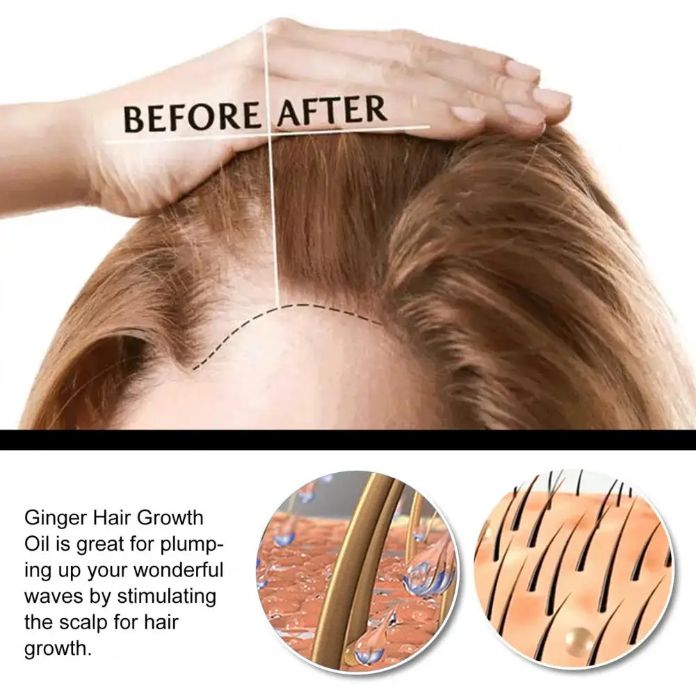 

Plant Extracts 30ml Universal Hair Care Growth Oil Mini Hair Growth Oils Safe Ingredients for Women