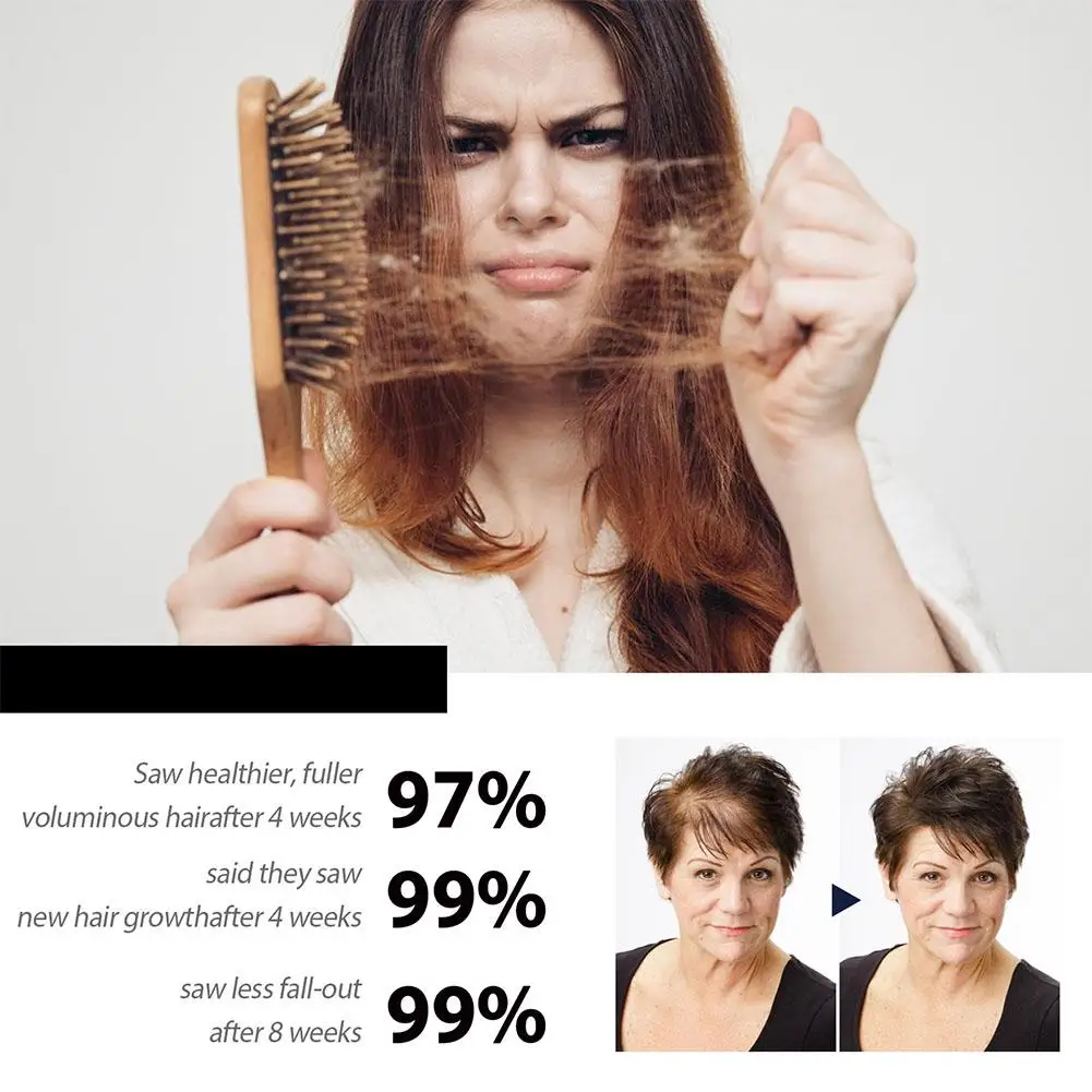 

Fast Scrub Products Anti Hair Loss Prevent Baldness Beard Dry Treatment Hair Scalp Damaged Plant Scrub Care Growth L2S0