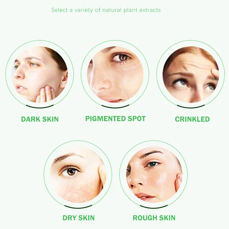 YOUNGCOME крем для лица с алоэ вера омолаживающее средство жирной кожи питание