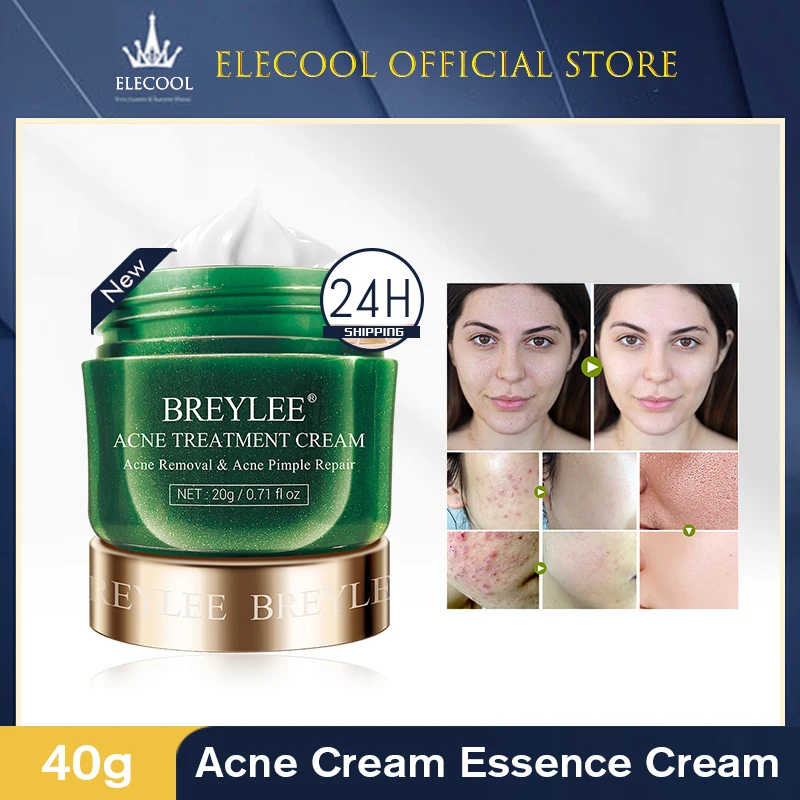 

Acne Treatment Cream Anti Acne Face Cream Pimple Removal Spots Oil Control Shrink Pores Moisturizing Skin Care Serum 20g