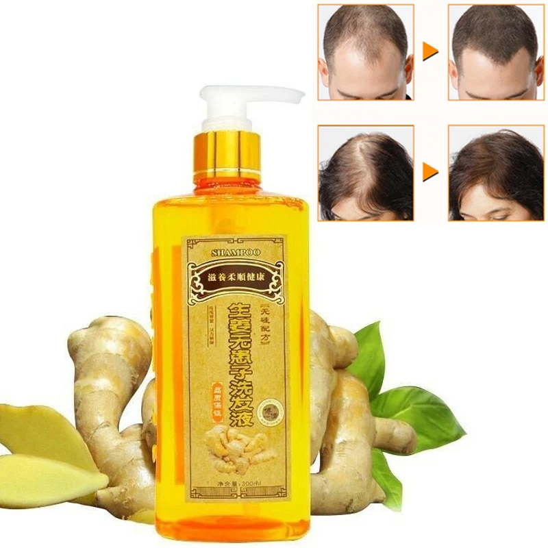 

Ginger Shampoo Anti Hair Loss Baldness Dandruff Effective Nourishing Moisturizing Grow Thick Hair Growth Shampoo Products