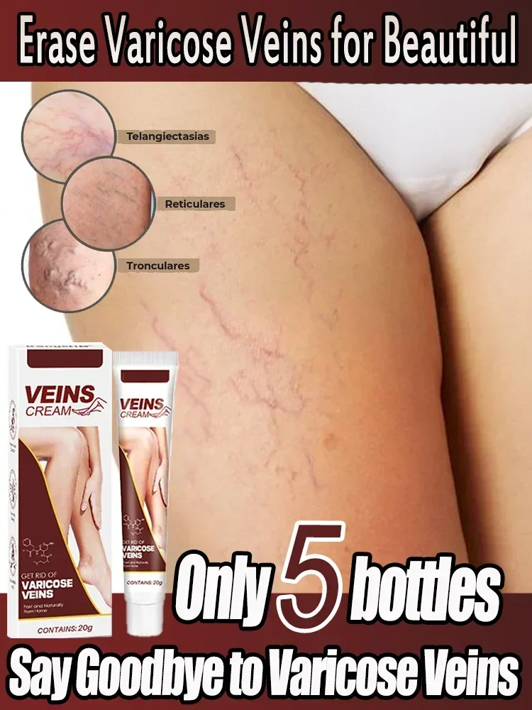 Эффективный крем для восстановления вен устранение боли в ногах отбеливающий