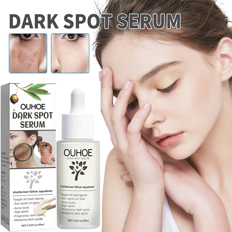 

Whitening Freckle Face Serum Remove Melasma Dark Acne Sunburn Spots Lighten Melanin Pigment Brighten Moisturizing Skin Care 30ml