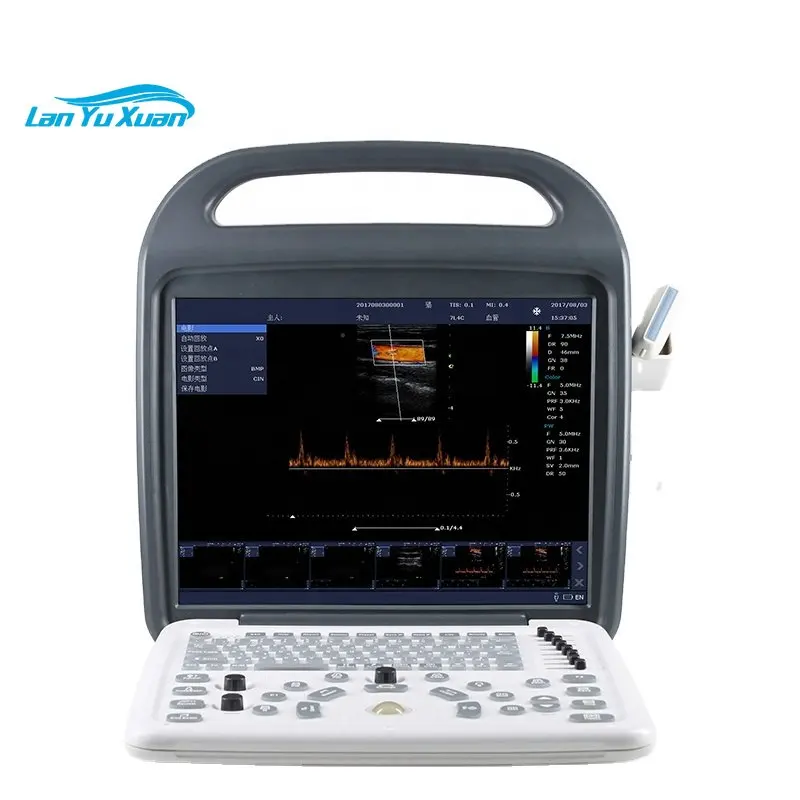 

Best Price High Resolution 15" LCD Cheap Medical Portable Color Doppler Ultrasound Machine for Hospital internal Li-battery