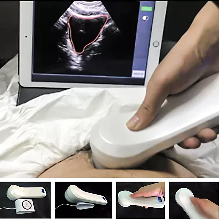 4D Bladder Scanner беспроводной ультразвуковой датчик портативный сканер работает с