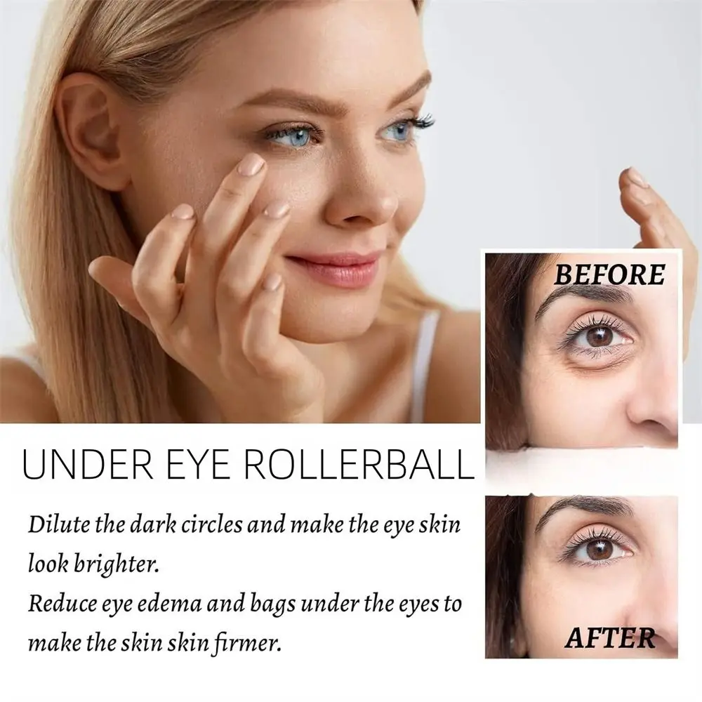 Лидер продаж роликовая Сыворотка для глаз с роликом удаления лазеток средство
