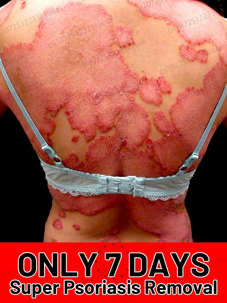 Быстро очищает кожу и восстанавливает ее здоровый гладкий