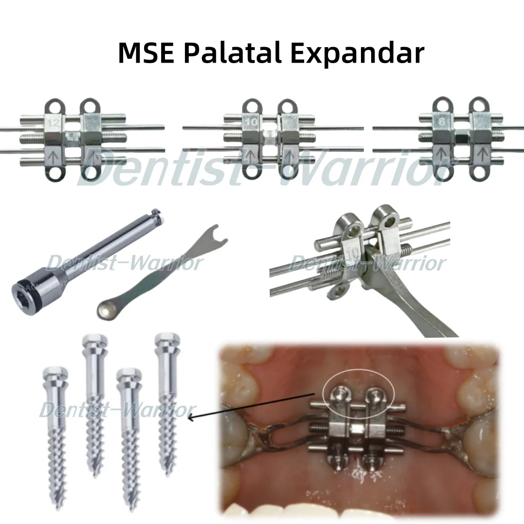 MSE стоматологический ортодонтический расширительный винт для среднего лица